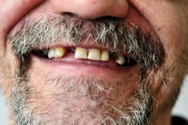 Chrub typického dezoláta v představách typického lepševika