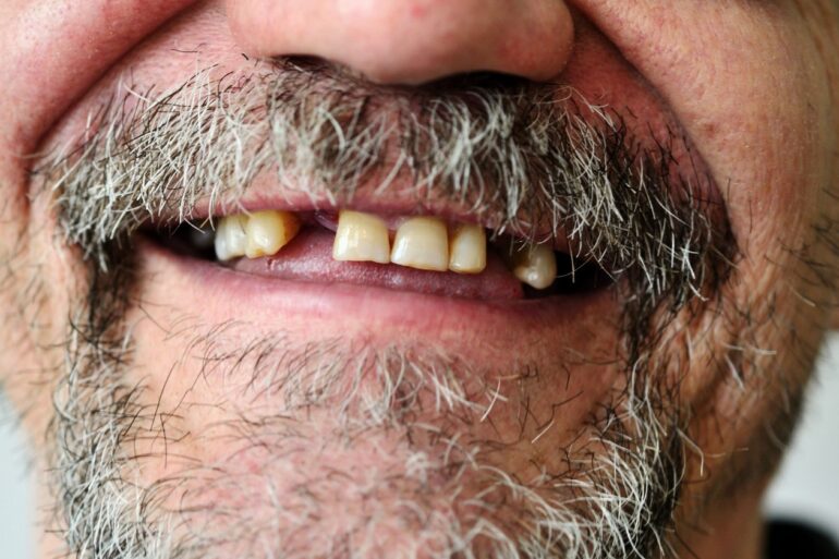 Chrub typického dezoláta v představách typického lepševika